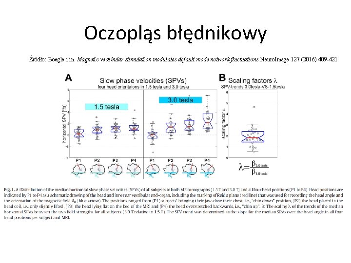 Oczopląs błędnikowy Źródło: Boegle i in. Magnetic vestibular stimulation modulates default mode network fluctuations