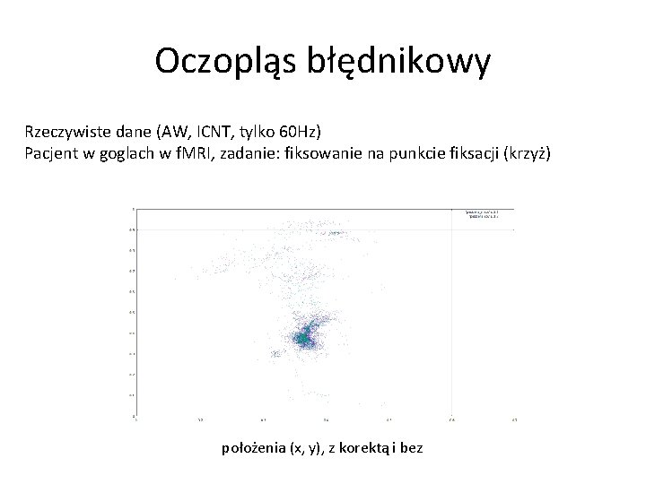 Oczopląs błędnikowy Rzeczywiste dane (AW, ICNT, tylko 60 Hz) Pacjent w goglach w f.