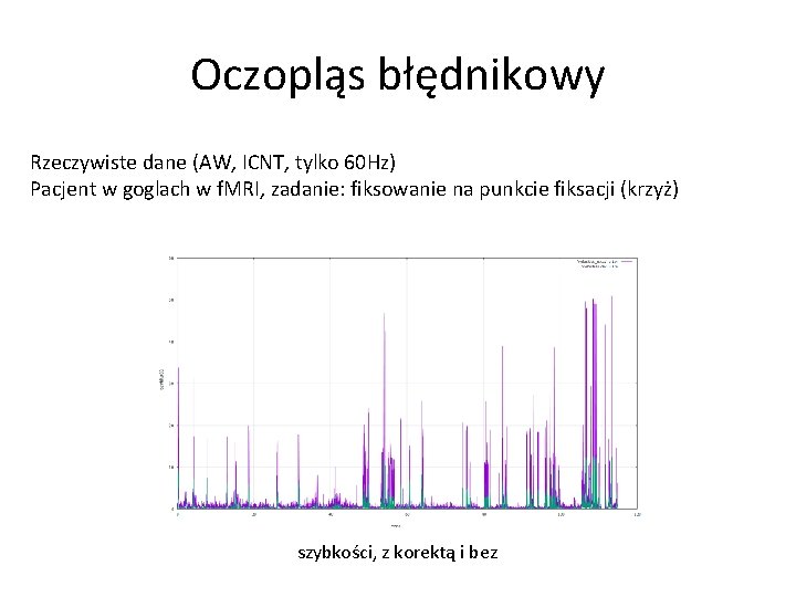 Oczopląs błędnikowy Rzeczywiste dane (AW, ICNT, tylko 60 Hz) Pacjent w goglach w f.