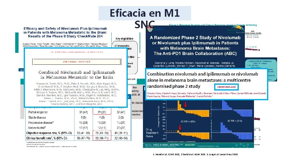 Eficacia en M 1 SNC 1. Hamid et al. ESMO 2018, 2. Tawbi et