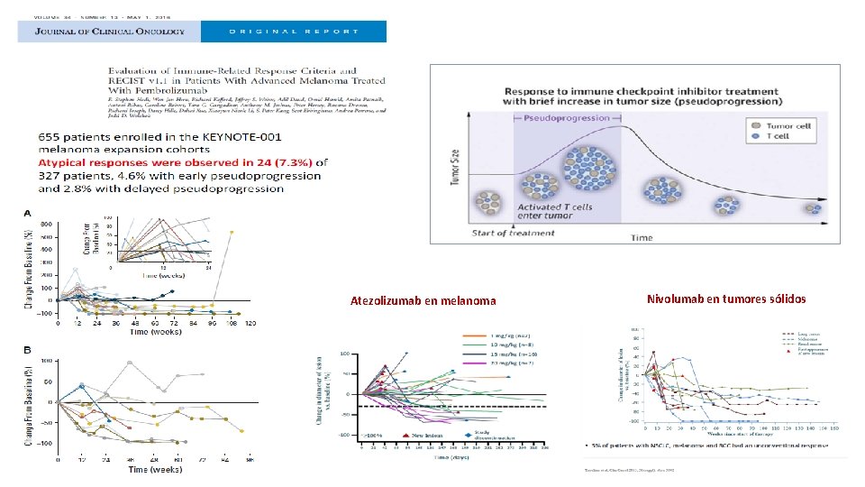 Atezolizumab en melanoma Nivolumab en tumores sólidos 