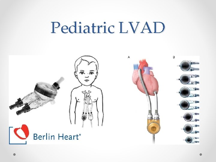 Pediatric LVAD 