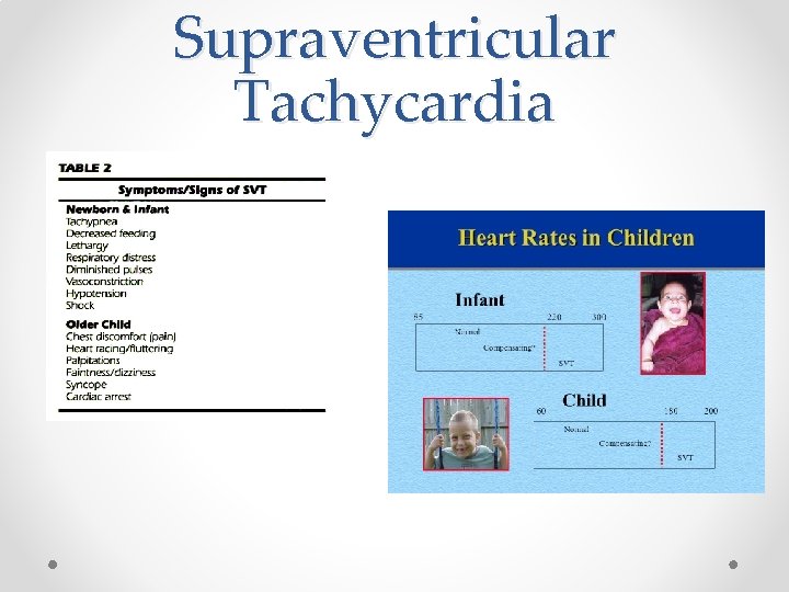 Supraventricular Tachycardia 