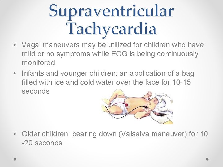 Supraventricular Tachycardia • Vagal maneuvers may be utilized for children who have mild or