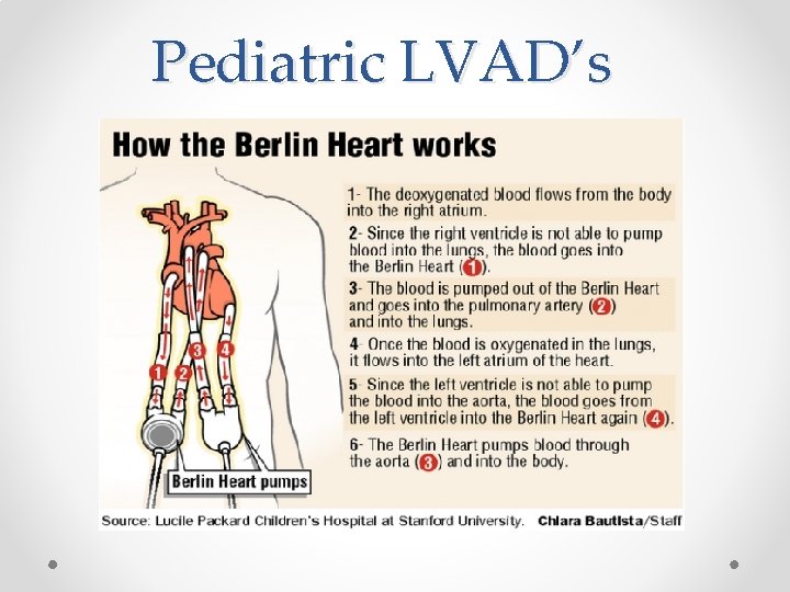 Pediatric LVAD’s 