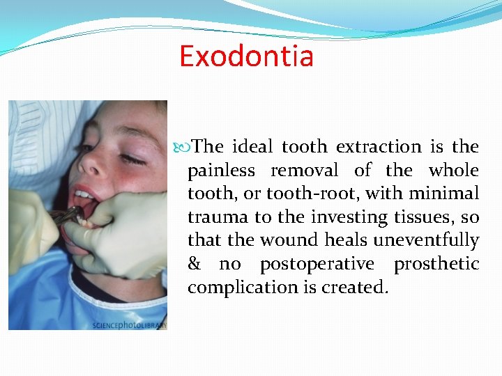Exodontia The ideal tooth extraction is the painless removal of the whole tooth, or