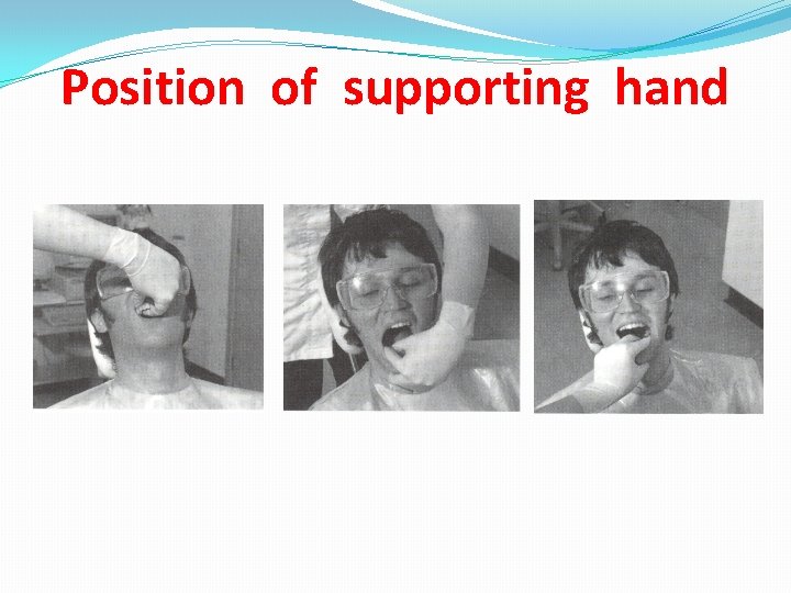 Position of supporting hand 