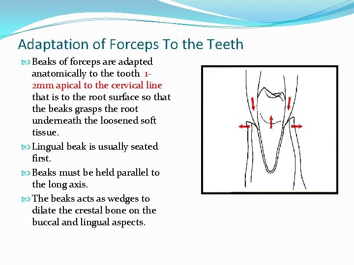 Adaptation of Forceps To the Teeth Beaks of forceps are adapted anatomically to the