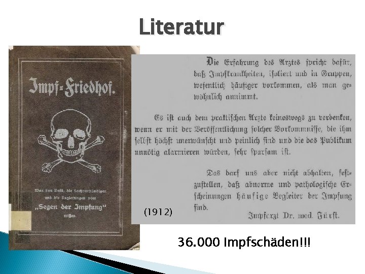Literatur (1912) 36. 000 Impfschäden!!! 