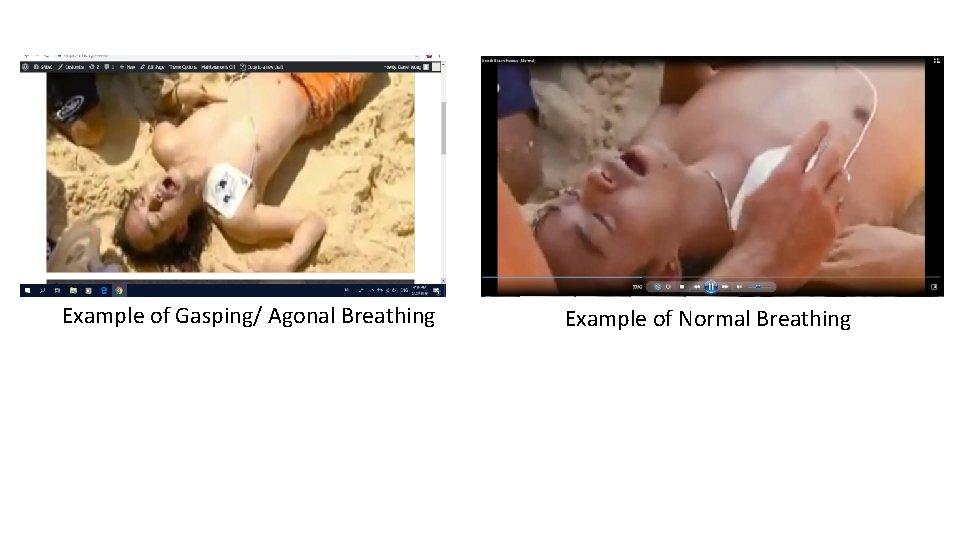 Example of Gasping/ Agonal Breathing Example of Normal Breathing 