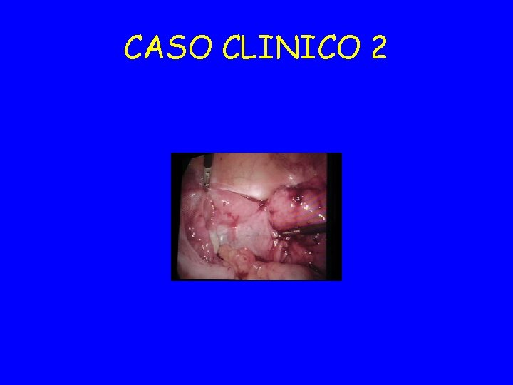 CASO CLINICO 2 