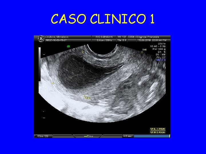 CASO CLINICO 1 
