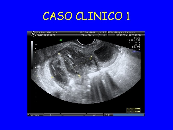 CASO CLINICO 1 