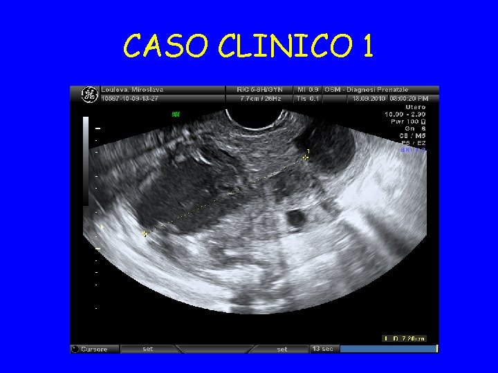 CASO CLINICO 1 