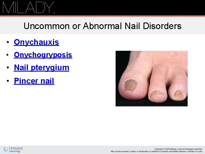 Uncommon or Abnormal Nail Disorders • Onychauxis • Onychogryposis • Nail pterygium • Pincer