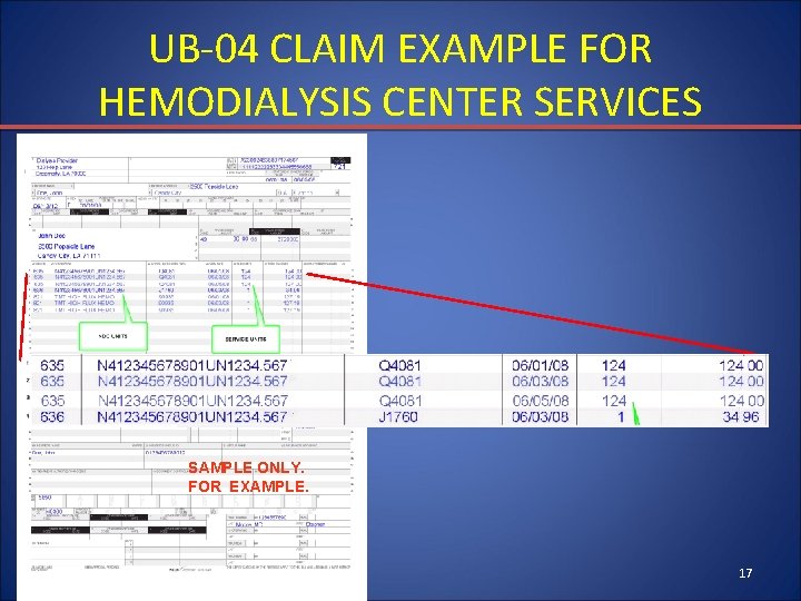 UB-04 CLAIM EXAMPLE FOR HEMODIALYSIS CENTER SERVICES SAMPLE ONLY. FOR EXAMPLE. 17 
