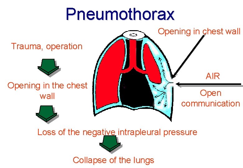 Pneumothorax Opening in chest wall Trauma, operation Opening in the chest wall AIR Open