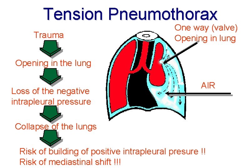 Tension Pneumothorax Trauma One way (valve) Opening in lung Opening in the lung Loss