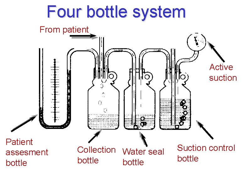 Four bottle system From patient Active suction Patient assesment bottle Collection Water seal bottle