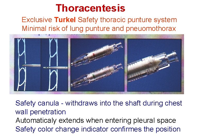 Thoracentesis Exclusive Turkel Safety thoracic punture system Minimal risk of lung punture and pneuomothorax Thoracentesis Exclusive Turkel Safety thoracic punture system Minimal risk of lung punture and pneuomothorax
