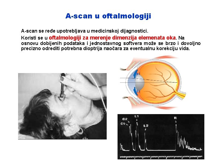 A-scan u oftalmologiji A-scan se ređe upotrebljava u medicinskoj dijagnostici. Koristi se u oftalmologiji