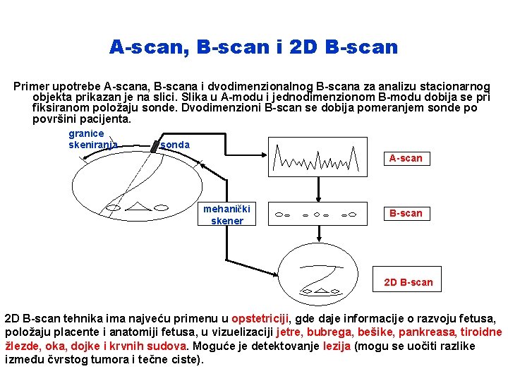 A-scan, B-scan i 2 D B-scan Primer upotrebe A-scana, B-scana i dvodimenzionalnog B-scana za