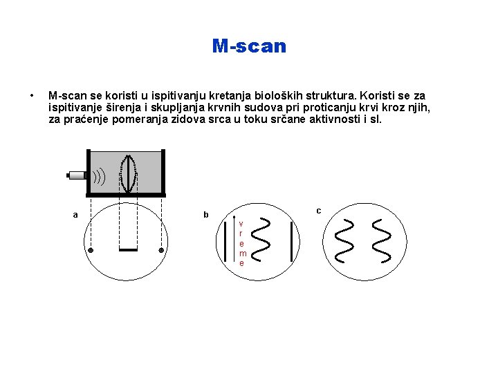 M-scan • M-scan se koristi u ispitivanju kretanja bioloških struktura. Koristi se za ispitivanje