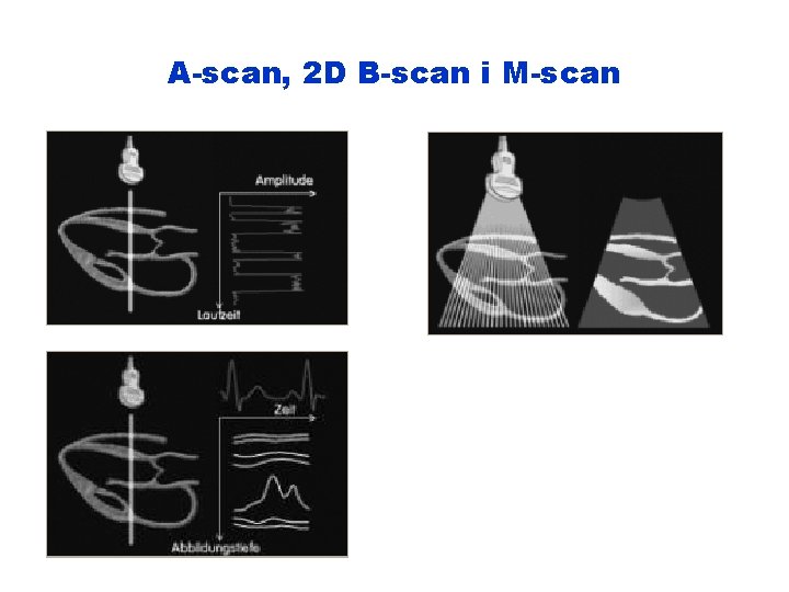 A-scan, 2 D B-scan i M-scan 