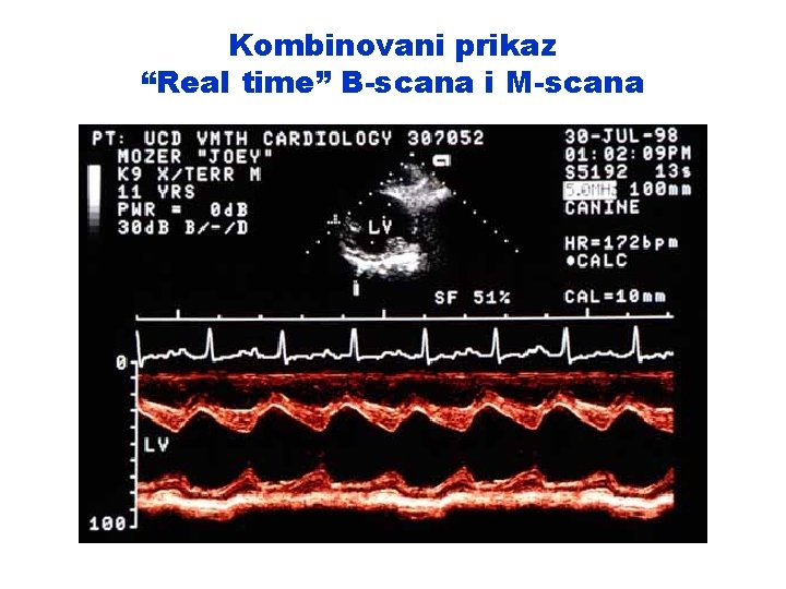 Kombinovani prikaz “Real time” B-scana i M-scana 