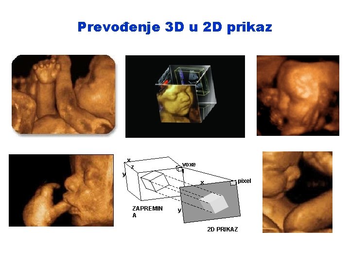 Prevođenje 3 D u 2 D prikaz x voxe l z y x ZAPREMIN