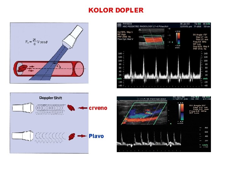 KOLOR DOPLER crveno Plavo 