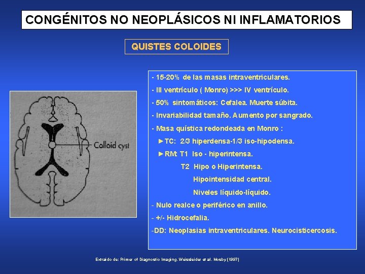 CONGÉNITOS NO NEOPLÁSICOS NI INFLAMATORIOS QUISTES COLOIDES - 15 -20% de las masas intraventriculares.