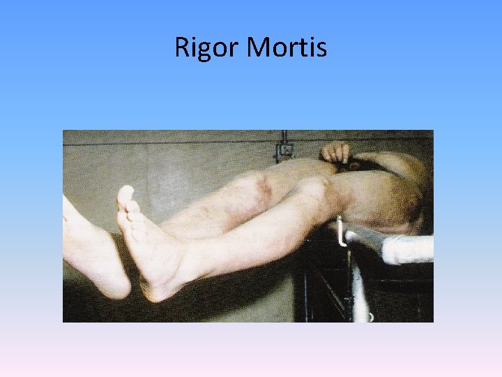 Rigor Mortis 