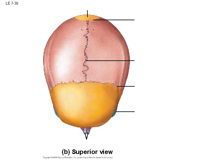 LE 7 -3 b Superior view LE 7 -3 b Superior view