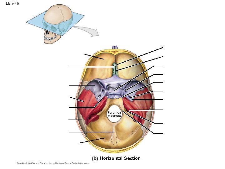 LE 7 -4 b Foramen magnum Horizontal Section LE 7 -4 b Foramen magnum Horizontal Section