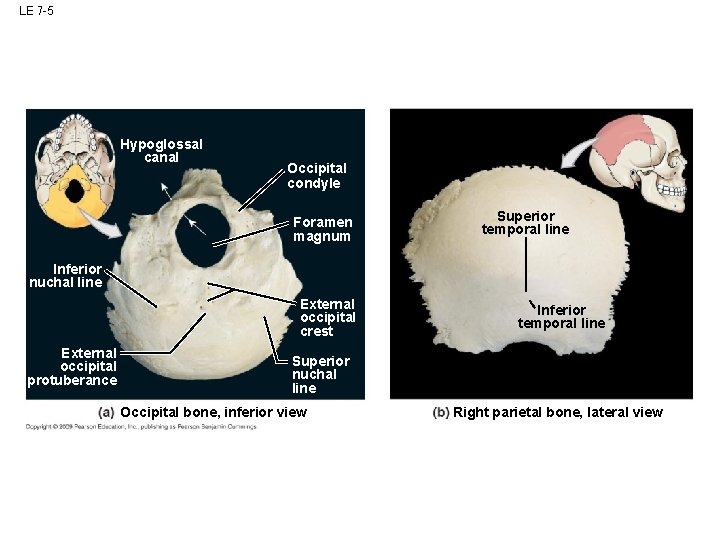 LE 7 -5 Hypoglossal canal Occipital condyle Foramen magnum Superior temporal line Inferior nuchal LE 7 -5 Hypoglossal canal Occipital condyle Foramen magnum Superior temporal line Inferior nuchal