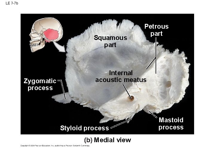 LE 7 -7 b Squamous part Zygomatic process Petrous part Internal acoustic meatus Styloid LE 7 -7 b Squamous part Zygomatic process Petrous part Internal acoustic meatus Styloid