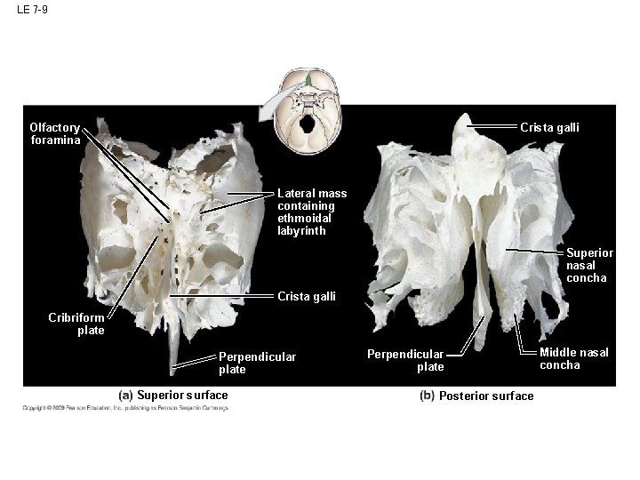 LE 7 -9 Crista galli Olfactory foramina Lateral mass containing ethmoidal labyrinth Superior nasal LE 7 -9 Crista galli Olfactory foramina Lateral mass containing ethmoidal labyrinth Superior nasal