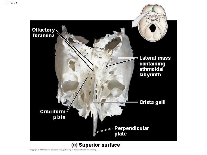 LE 7 -9 a Olfactory foramina Lateral mass containing ethmoidal labyrinth Crista galli Cribriform LE 7 -9 a Olfactory foramina Lateral mass containing ethmoidal labyrinth Crista galli Cribriform