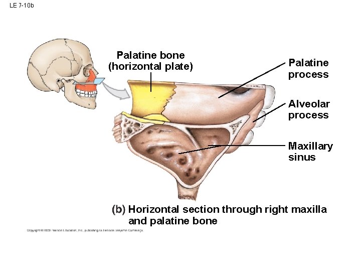 LE 7 -10 b Palatine bone (horizontal plate) Palatine process Alveolar process Maxillary sinus LE 7 -10 b Palatine bone (horizontal plate) Palatine process Alveolar process Maxillary sinus