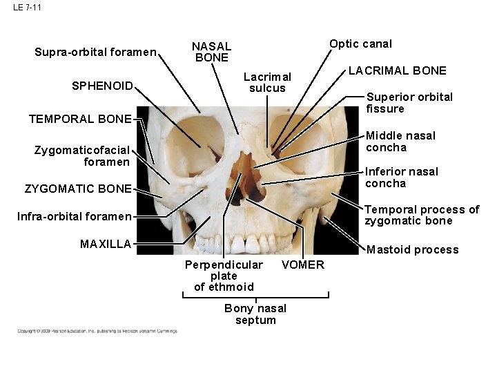 LE 7 -11 Supra-orbital foramen SPHENOID Optic canal NASAL BONE Lacrimal sulcus TEMPORAL BONE LE 7 -11 Supra-orbital foramen SPHENOID Optic canal NASAL BONE Lacrimal sulcus TEMPORAL BONE