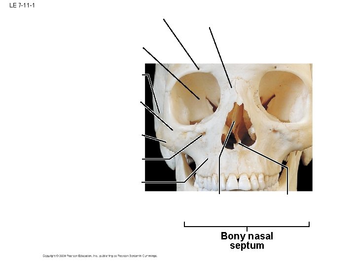 LE 7 -11 -1 Bony nasal septum LE 7 -11 -1 Bony nasal septum