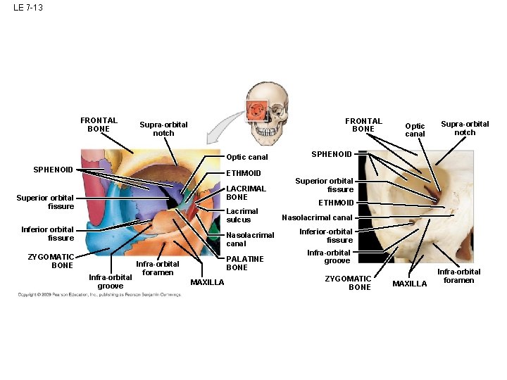 LE 7 -13 FRONTAL BONE Supra-orbital notch Optic canal SPHENOID ETHMOID LACRIMAL BONE Superior LE 7 -13 FRONTAL BONE Supra-orbital notch Optic canal SPHENOID ETHMOID LACRIMAL BONE Superior
