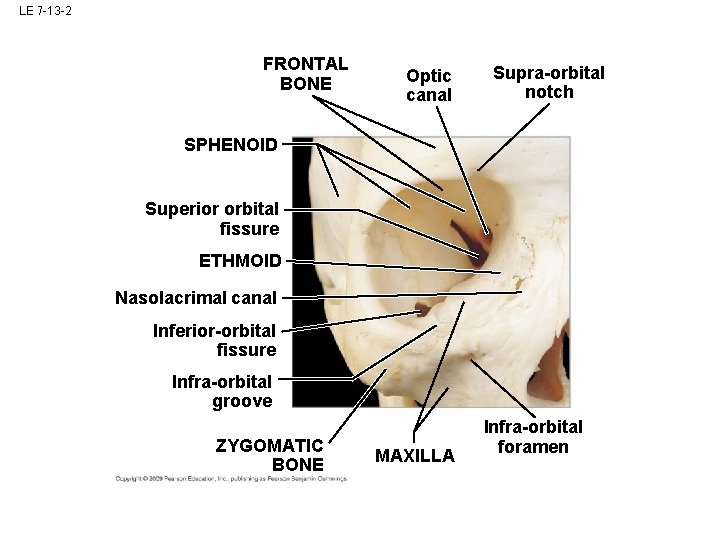 LE 7 -13 -2 FRONTAL BONE Optic canal Supra-orbital notch SPHENOID Superior orbital fissure LE 7 -13 -2 FRONTAL BONE Optic canal Supra-orbital notch SPHENOID Superior orbital fissure
