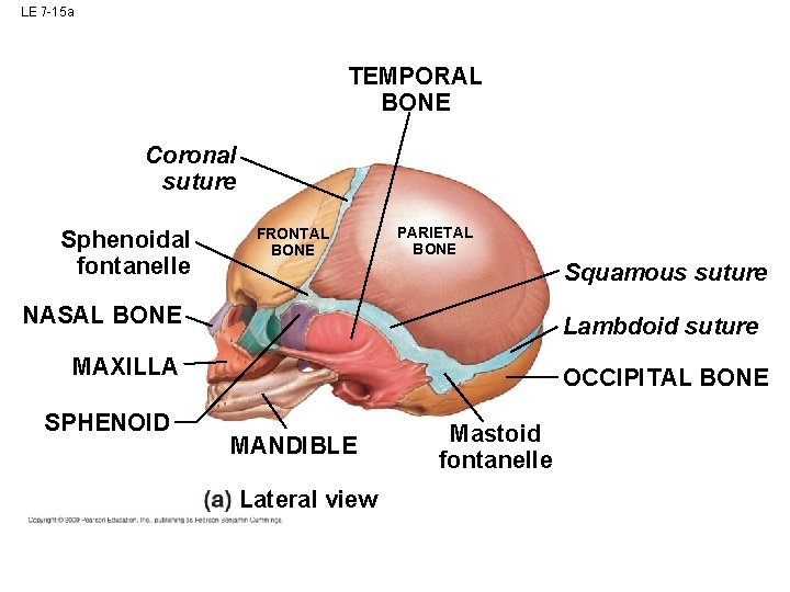 LE 7 -15 a TEMPORAL BONE Coronal suture Sphenoidal fontanelle FRONTAL BONE PARIETAL BONE LE 7 -15 a TEMPORAL BONE Coronal suture Sphenoidal fontanelle FRONTAL BONE PARIETAL BONE