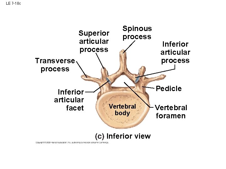 LE 7 -18 c Superior articular process Spinous process Transverse process Inferior articular facet LE 7 -18 c Superior articular process Spinous process Transverse process Inferior articular facet