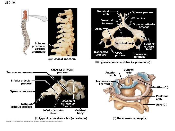 LE 7 -19 Vertebral arch C 1 C 2 Spinous process Lamina Vertebral foramen LE 7 -19 Vertebral arch C 1 C 2 Spinous process Lamina Vertebral foramen