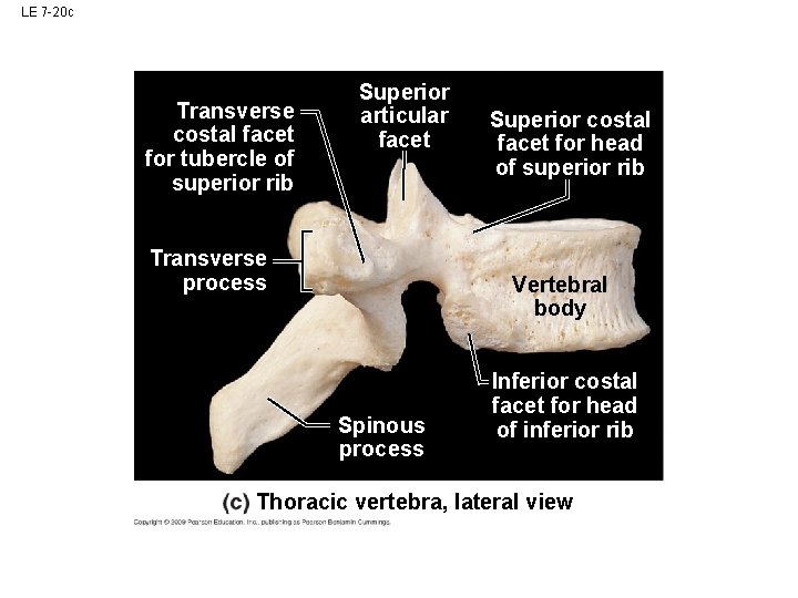 LE 7 -20 c Transverse costal facet for tubercle of superior rib Superior articular LE 7 -20 c Transverse costal facet for tubercle of superior rib Superior articular