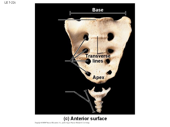 LE 7 -22 c Base Transverse lines Apex Anterior surface LE 7 -22 c Base Transverse lines Apex Anterior surface