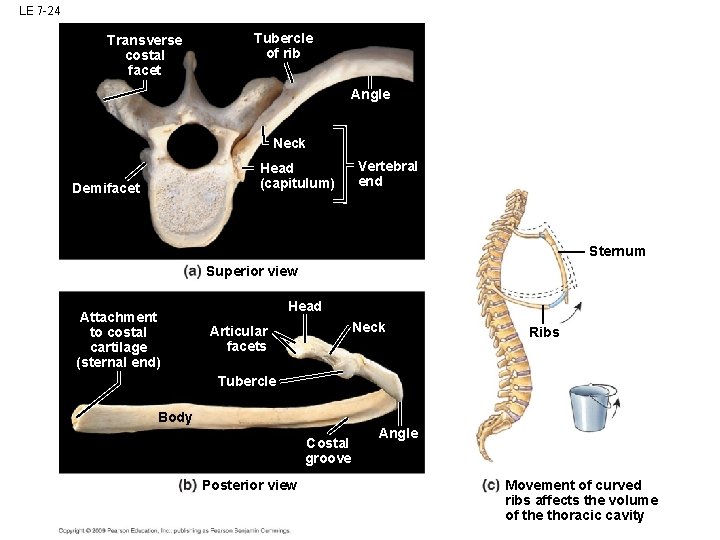 LE 7 -24 Transverse costal facet Tubercle of rib Angle Neck Head (capitulum) Demifacet LE 7 -24 Transverse costal facet Tubercle of rib Angle Neck Head (capitulum) Demifacet